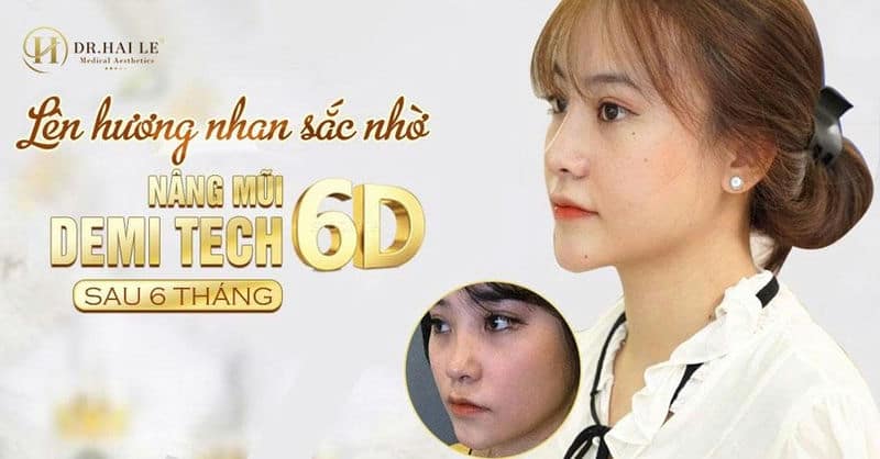 Mặc cảm vì gương mặt với sống mũi thấp khiến gương mặt "Kém sang" cản trở tới công việc mẫu ảnh