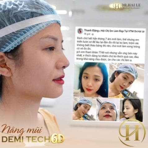 Feedback Đặng Thanh