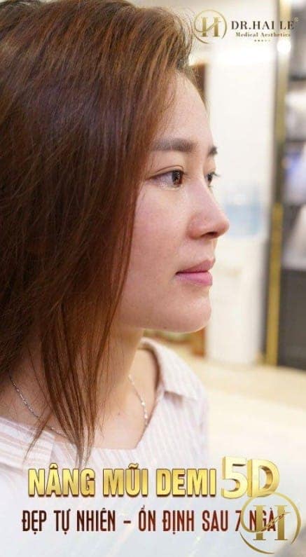 Hoài Thương 3