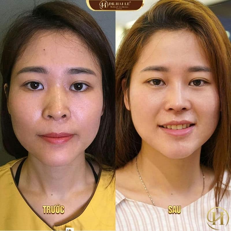 Hoài Thương