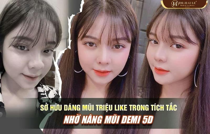 Hải Yến và bí quyết sở hữu dáng mũi triệu like trong tích tắc