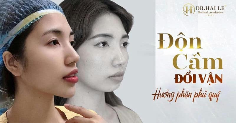 Tận mắt chứng kiến màn lột xác của diễn viên Thu Quỳnh