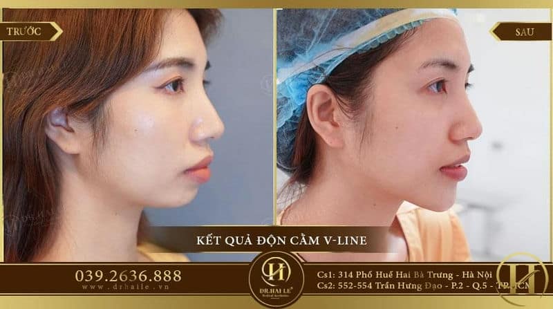 Kq Thu Quỳnh