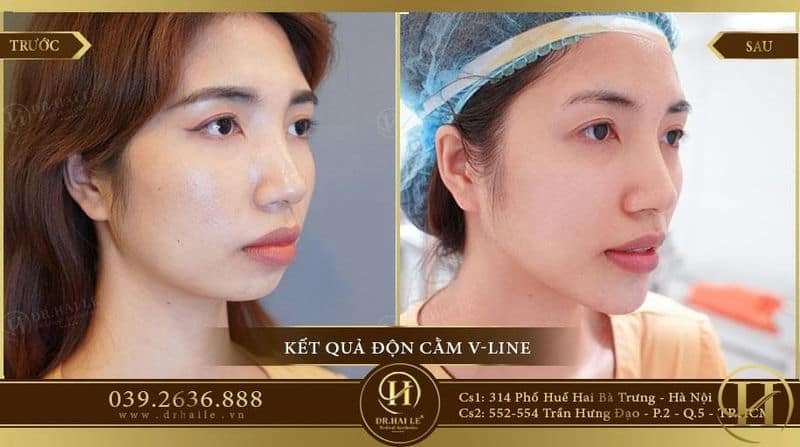 Kq Thu Quỳnh 2
