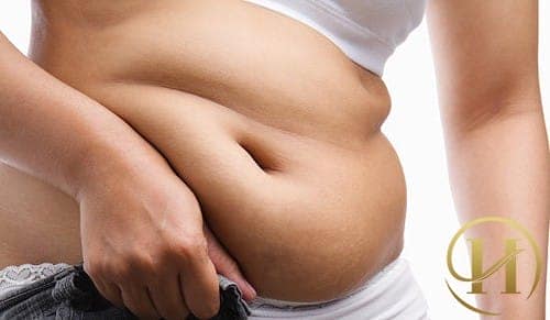 Mỡ bụng nỗi ám ảnh thường trực của chị em phụ nữ