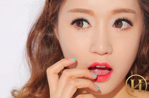 Cắt mí Mini Deep 5D bao lâu thì đẹp?