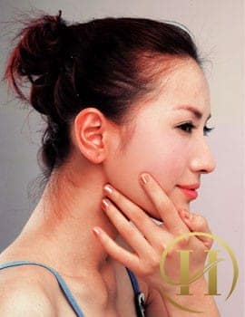 Massage giúp gương mặt thon gọn