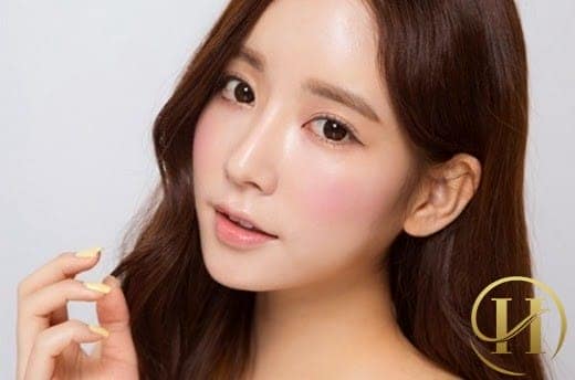 Cắt mí mắt Mini Deep 5D sưng trong bao lâu?