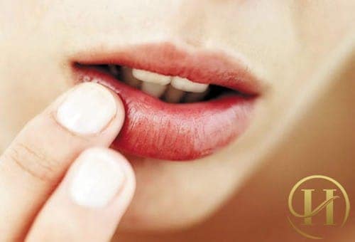 Dùng tay để tẩy son sẽ khiến môi dễ bị tổn thương