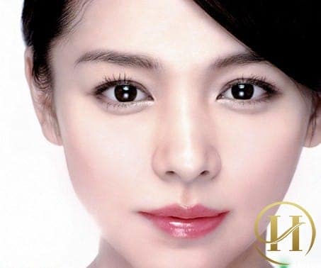 Cắt mí Mani Mini Deep 5D đang tạo nên một cơn sốt trên thị trường thẩm mỹ