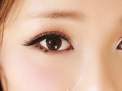 4 Ưu điểm vượt trội của cắt mí 5D