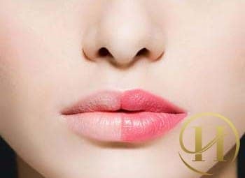 Môi sẽ kém sắc nếu tiếp xúc nhiều với ánh nắng