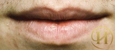 Tim và phổi của bạn đang không được khỏe nếu môi xanh tái