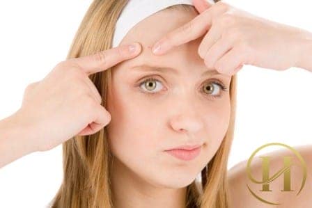 Tìm hiểu sức khỏe cơ thể qua vị trí mụn mọc