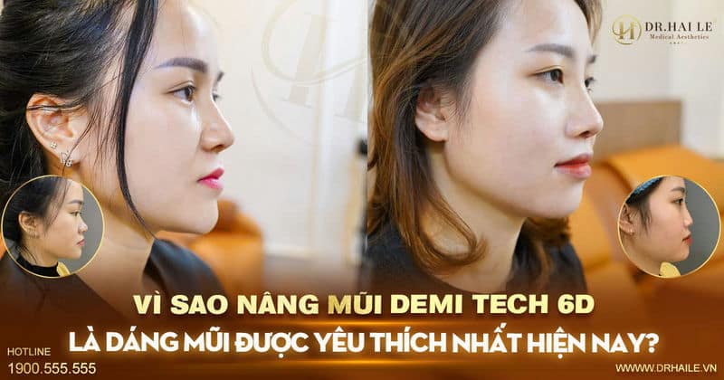 Vì sao Nâng mũi Demi Tech 6D là dáng mũi được yêu thích nhất hiện nay?