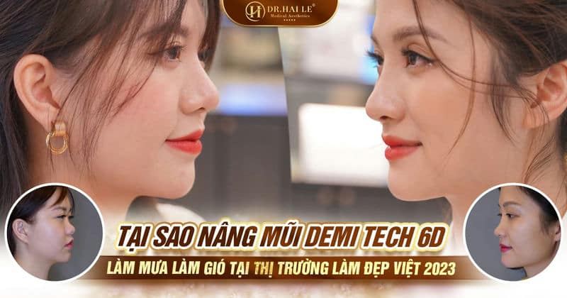 Tại sao Nâng mũi Demi Tech 6D làm mưa làm gió tại thị trường làm đẹp Việt 2023