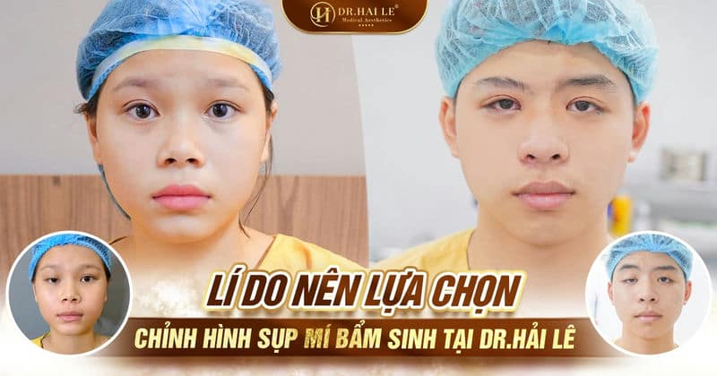 Lý do nên lựa chọn chỉnh hình sụp mí bẩm sinh tại Dr.Hải Lê Lý do nên lựa chọn chỉnh hình sụp mí bẩm sinh tại Dr.Hải Lê