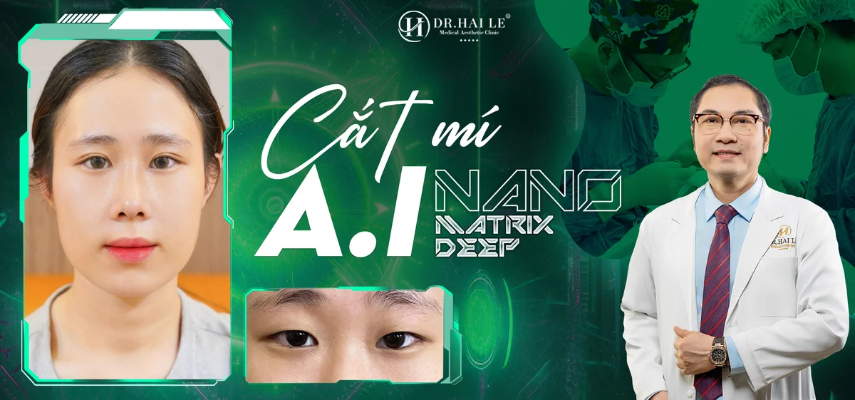 Cắt mí AI - Nano Matrix Deep có gì khác so với các phương pháp cắt mí truyền thống?