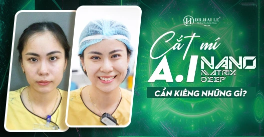 Cắt mí AI - Nano Matrix Deep cần kiêng những gì? Cắt mí AI - Nano Matrix Deep cần kiêng những gì?