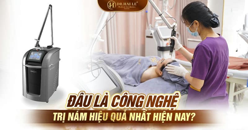 Đâu là công nghệ trị nám hiệu quả nhất hiện nay?