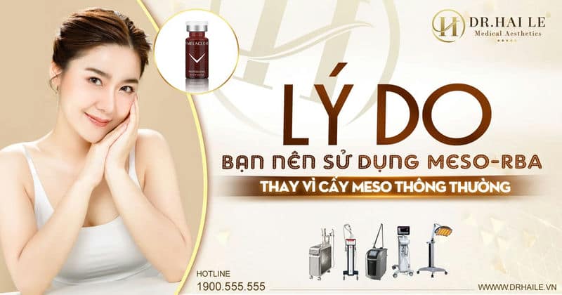 Lý do bạn nên sử dụng Meso-RBA thay vì cấy Meso thông thường