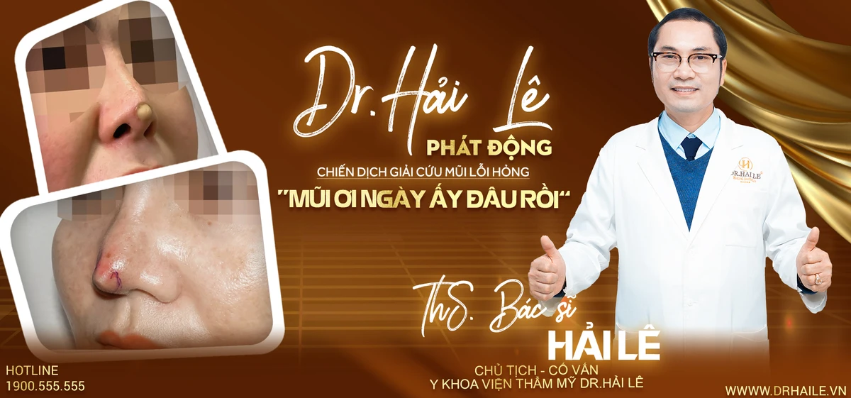 Dr.Hải Lê phát động chiến dịch Giải cứu mũi lổi hỏng "Mũi ơi ngày ấy đây rồi"