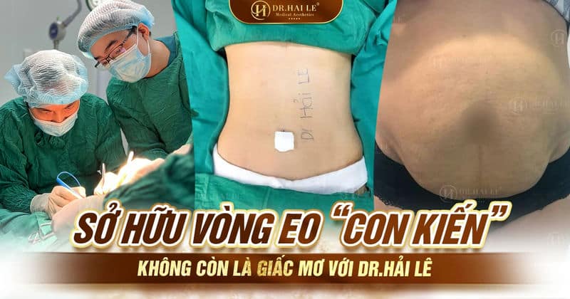 Sở hữu vòng eo “con kiến” không còn là giấc mơ với Dr.Hải Lê