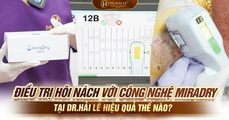 Điều trị hôi nách với công nghệ miraDry tại Dr.Hải Lê hiệu quả thế nào?