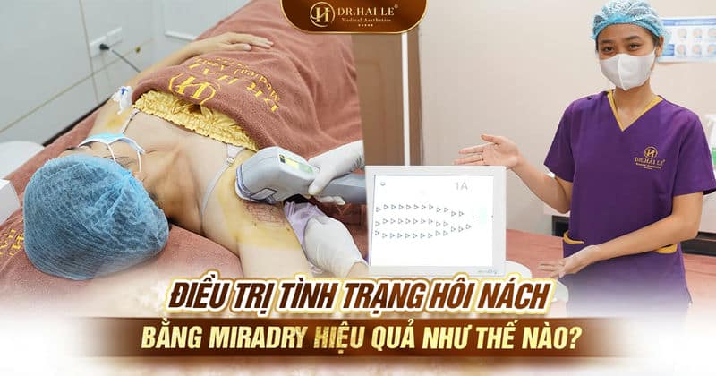 Điều trị tình trạng hôi nách bằng miraDry hiệu quả như thế nào?