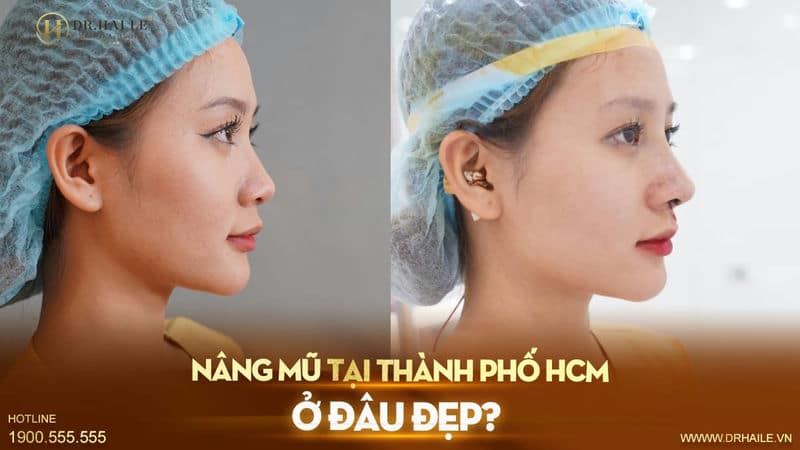 Nâng mũi tại thành phố HCM ở đâu đẹp?