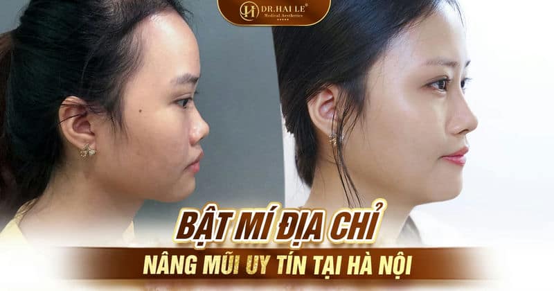 Địa chỉ nâng mũi uy tín tại Hà Nội
