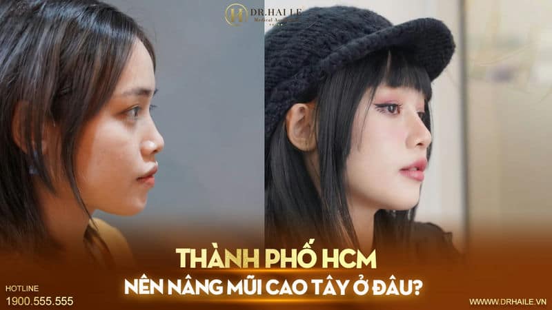 Thành phố HCM nên nâng mũi cao tây ở đâu?