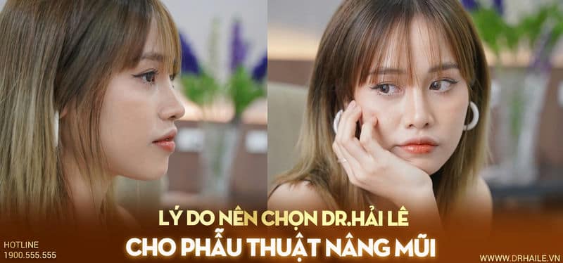 Lý do nên chọn Dr.Hải Lê cho phẫu thuật nâng mũi