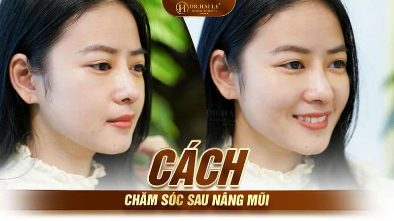 Cách chăm sóc sau phẫu thuật nâng mũi
