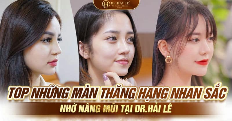 Top những màn thăng hạng nhan sắc nhờ nâng mũi tại Dr.Hải Lê
