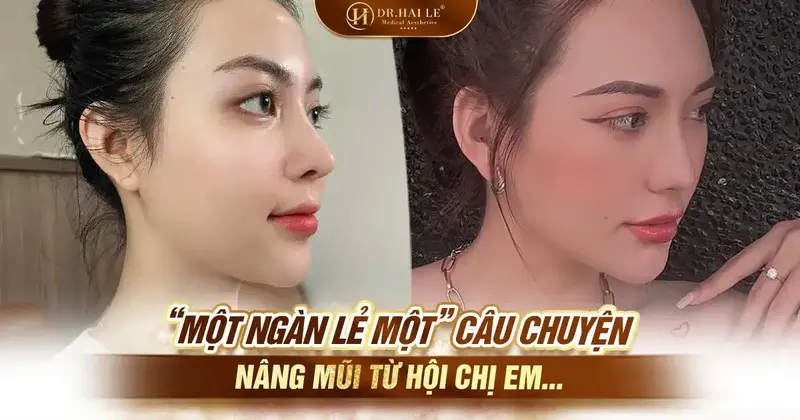 “Một ngàn lẻ một” câu chuyện nâng mũi từ Hội chị em…