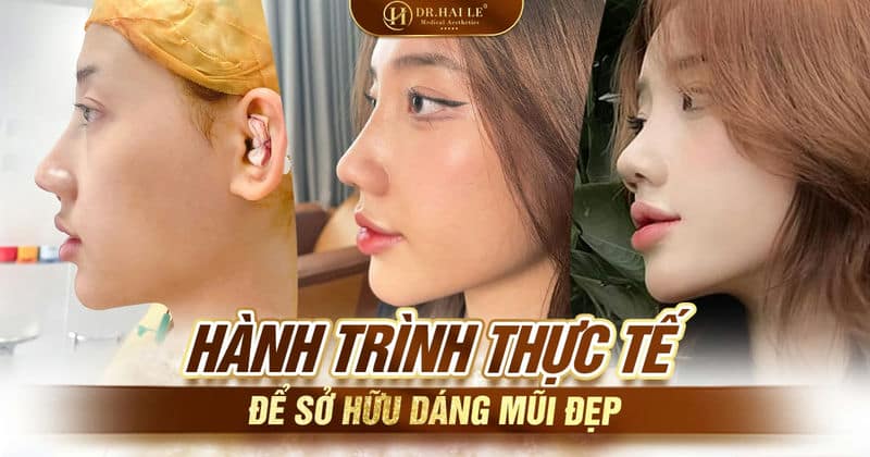 Hành trình thực tế để sở hữu dáng mũi đẹp