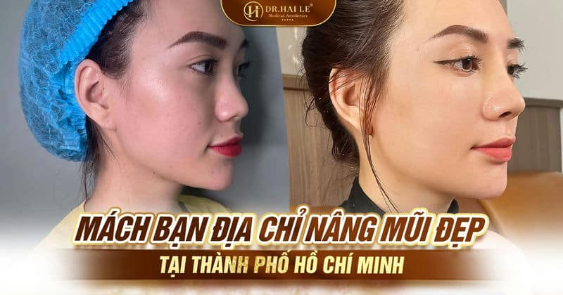 Mách bạn địa chỉ nâng mũi đẹp tại Thành phố Hồ Chí Minh
