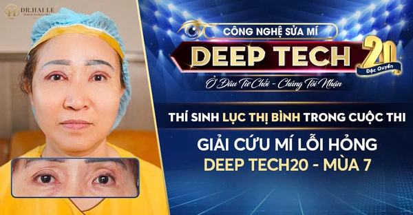 Thí Sinh Lục Thị Bình Trong Cuộc Thi “Giải Cứu Mí Lỗi Hỏng Deep Tech20 – Mùa 7” Thí Sinh Lục Thị Bình Trong Cuộc Thi “Giải Cứu Mí Lỗi Hỏng Deep Tech20 – Mùa 7”