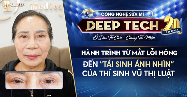 Hành Trình Từ Mắt Lỗi Hỏng Đến “Tái Sinh Ánh Nhìn” Của Thí Sinh Vũ Thị Luật Hành Trình Từ Mắt Lỗi Hỏng Đến “Tái Sinh Ánh Nhìn” Của Thí Sinh Vũ Thị Luật