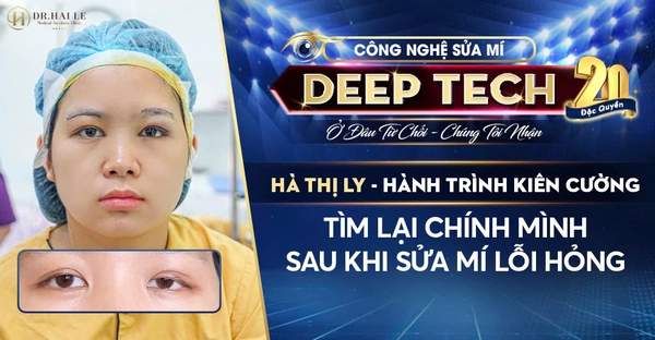 Hà Thị Ly – Hành Trình Kiên Cường Tìm Lại Chính Mình Sau Khi Sửa Mí Lỗi Hỏng Hà Thị Ly – Hành Trình Kiên Cường Tìm Lại Chính Mình Sau Khi Sửa Mí Lỗi Hỏng