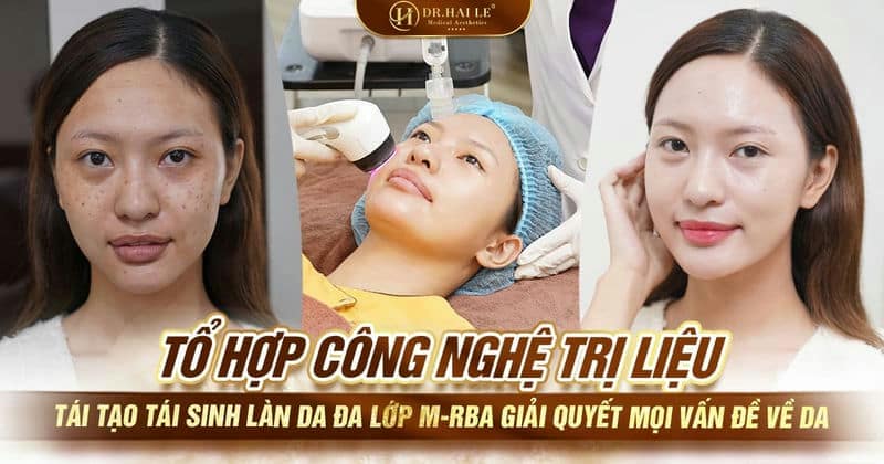 Tổ hợp công nghệ trị liệu tái tạo tái sinh làn da đa lớp M-RBA giải quyết mọi vấn đề về da