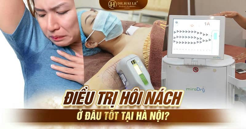 Điều trị hôi nách ở đâu tốt tại Hà Nội?