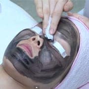  Bôi hạt cacbon chuyên dụng tại vùng cần điều trị 