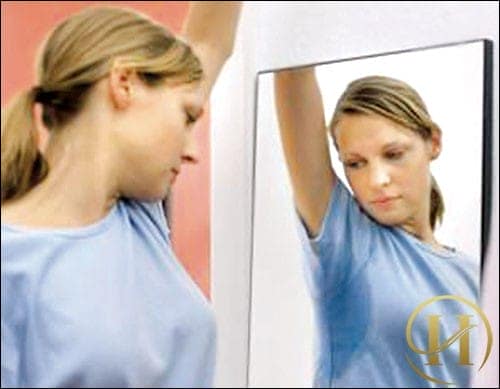 Sau khi trị hôi nách cần chăm sóc như thế nào?