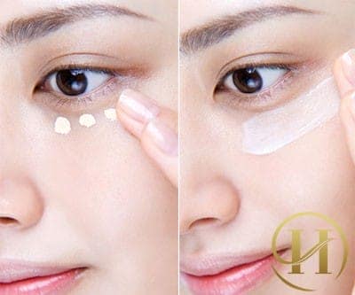 Giải đáp thắc mắc về vùng da quanh mắt