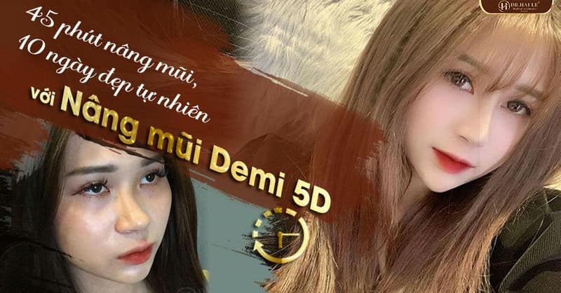 Đỗ phương: Hành trình từ dáng mũi vạn người chê đến Hotgirl vạn người mê