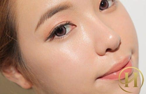 Nhấn mí đẹp ỏ Sài Gòn