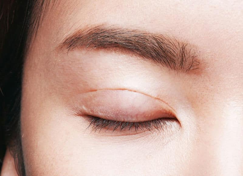 Nhấn mí bằng chỉ có gây hại gì không?
