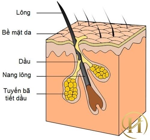 Cấu tạo của nang lông là một nguyên nhân gián tiếp làm lỗ chân lông to
